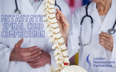 spinal cord compression diagnostic tests|treatment for spinal cord compression.